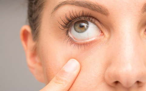 Need Best Daily Contacts for Dry Eyes Top 6 Moist Options for All Day Wear